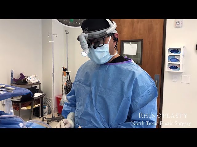 Procedimiento de rinoplastia de cirugía plástica del norte de Texas