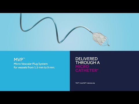 Overview of the Medtronic Peripheral Embolization Portfolio: Onyx™, MVP™, Concerto™ and Rebar™