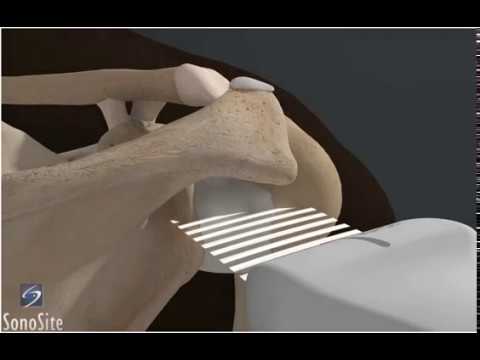 How To: Shoulder Glenohumeral Joint 3D Video