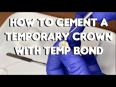 Темп Бонд НЕ, TEMP-BOND NE Automix, Temp Bond NE, 11,8г (Kerr) - фото 1 - id-p2746507589