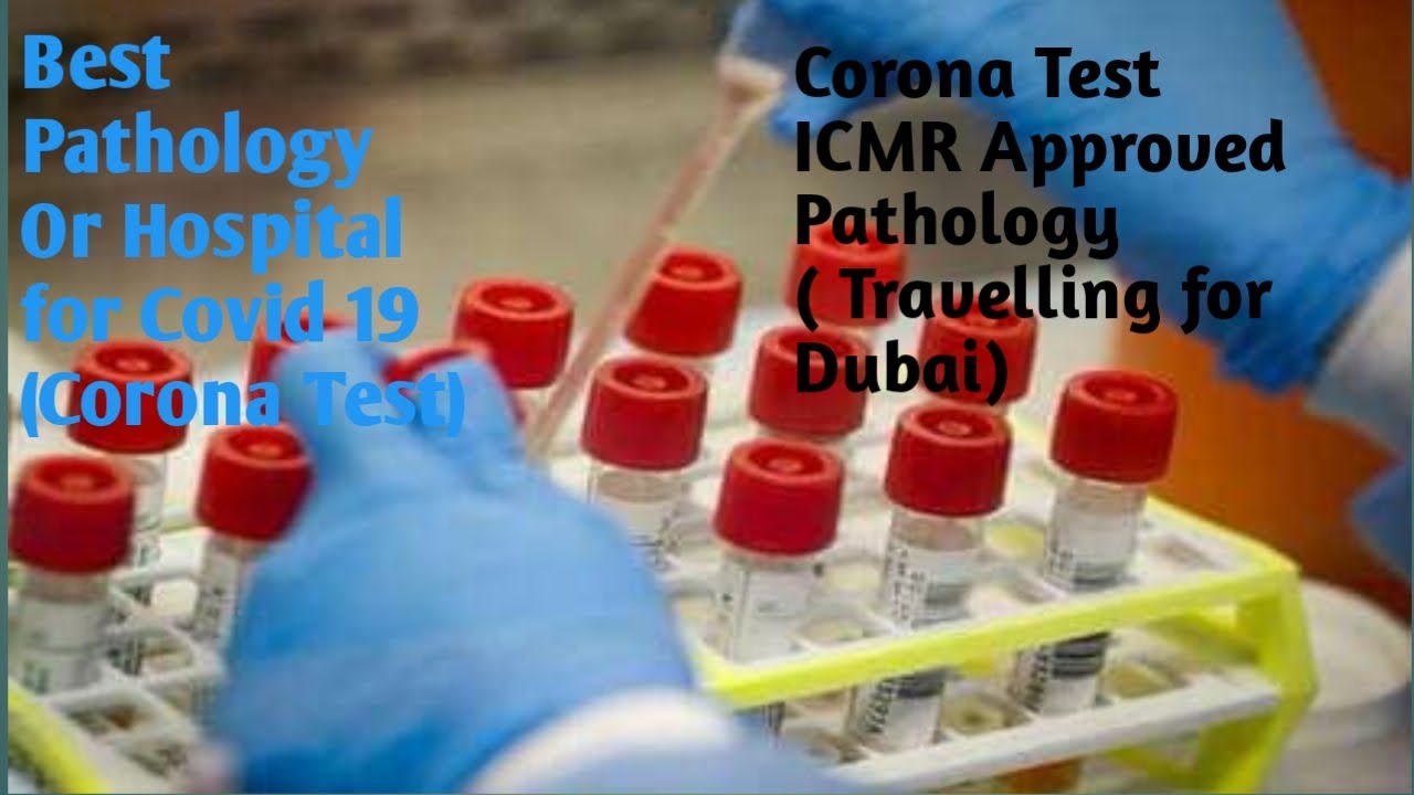 Best Pathology Or Hospital for Corona(COVID 19) Test in Lucknow