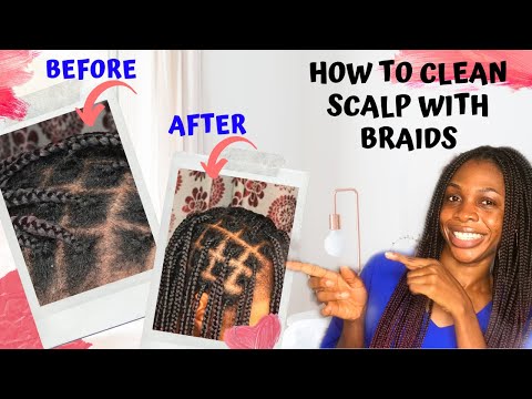 HOW TO CLEAN SCALP WITH BRAIDS WITHOUT WASHING |...