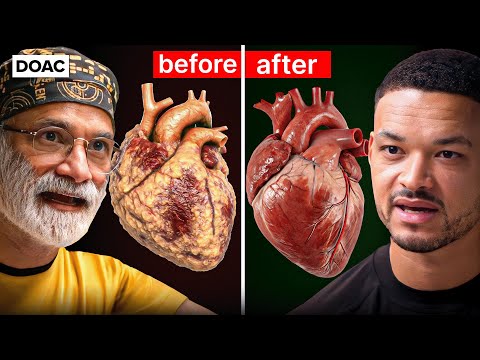 @TheDiaryOfACEO - "Insulin & Heart Doctor: The Fastest Way To Burn Dangerous Visceral Fat! This Is Clotting Your Blood!"