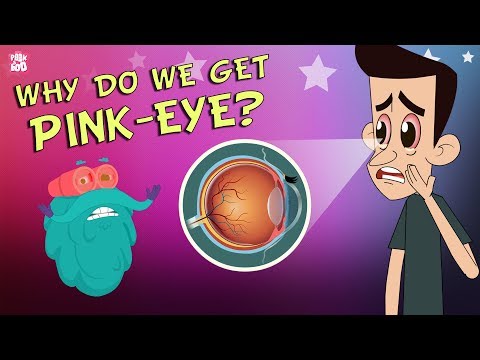 What Causes Conjunctivitis? | CONJUNCTIVITIS | Pink-Eye | The Dr Binocs Show | Peekaboo Kidz