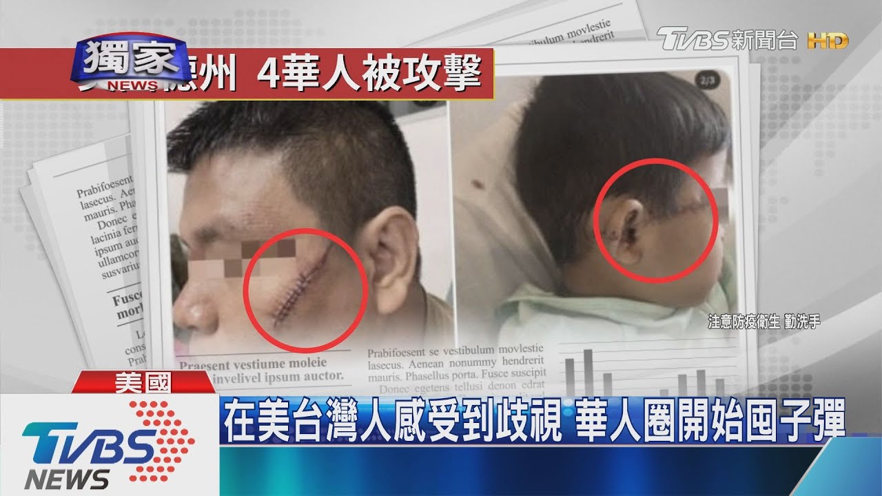 在美台灣人感受到歧視　華人圈開始囤子彈