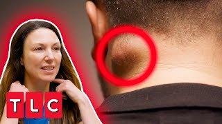 GIANT Neck Cyst Has Kept This Man From Dating | The Bad Skin Clinic