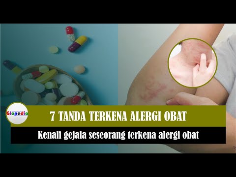 7 TANDA TERKENA ALERGI OBAT !!!! KENALI GEJALA SESEORANG TERKENA ALERGI OBAT #glopedia #kesehatan