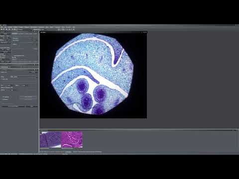 Quick tip #13 - Koehler Illumination