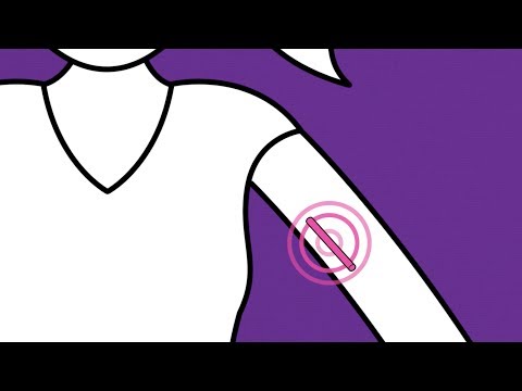 Brook Contraception - Contraceptive Implant Animation