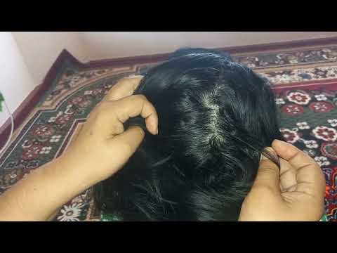Getting out all most of lice from brown hair - How to remove lice from her head