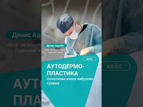 аутодермопластика