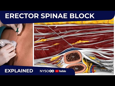 Erector Spinae Plane Block - Regional anesthesia Crash course with Dr. Hadzic