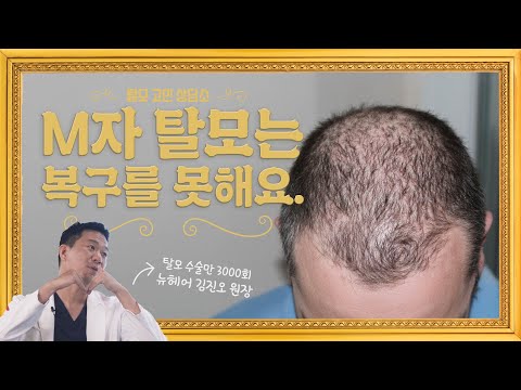 可以修复M字脱发吗？ | EP1. Monaliza烦恼咨询所（W. 金镇伍院长）