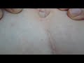 Woman Plays With Her Belly Button While Her Belly Yearns For Food