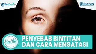 Pandangan Mata Terganggu akibat Bintitian, Kenali Penyebab dan Cara Mengatasi dengan Bahan Alami
