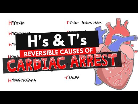 Reversible Causes of Cardiac Arrest Hs and Ts Mnemonic | H's & T's Mnemonic