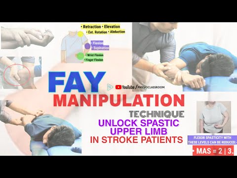 AN INTRODUCTION TO BRUNNSTROM APPROACH MOVEMENT THERAPY IN HEMIPLEGIA