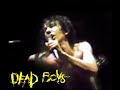 Dead Boys - Ain't Nothin' To Do (Live).