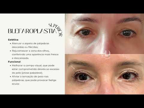 HD CLINIC - MEDICINA ESTÉTICA, CIRURGIA E ESTÉTICA EM LIBOA - PORTUGAL