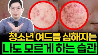 여드름 함부로 짜면 얼굴 무조건 망가져요! 피부과 전문의가 금지하는 여드름 피부 습관 알려드릴게요