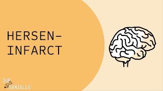 Herseninfarct