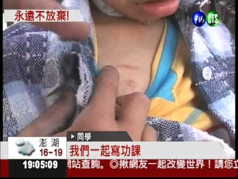 抗癌小鬥士豆豆 病情惡化住院