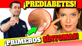 ¡PELIGRO! SINTOMAS DE ALARMA de PREDIABETES y RESISTENCIA a INSULINA| GLUCOSA MUY ALTA en la SANGRE