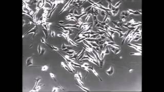 Karel Kryl - Rakovina