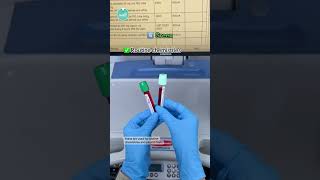 Download lagu Order of Lab Draw 🩸🧪 mp3 Download lagu Order of Lab Draw 🩸🧪 mp3