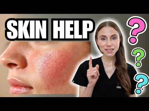 Dermatologist Q&A: Everyday Skin Problems Explained