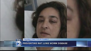 State investigates rat lungworm cases; Maui victim describes pain worse than childbirth