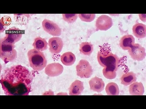 ブルセラ症について詳しく解説