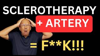 Sclerotherapy NIGHTMARE: Accidental Artery Injection (MUST WATCH!); The Most Important Complication