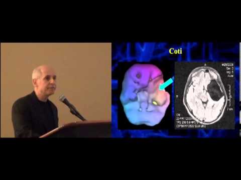 Dr. Daniel Amen | Brain SPECT Imaging - Psychiatry's Tool to Save Lives