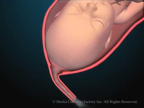 難産は知能を向上させたのか?