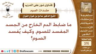 صورة ما ضابط الدم الخارج من الجسد المفسد للصوم، وكيف يُفسد الصوم؟ الشيخ صالح بن فوزان الفوزان