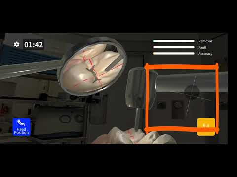 Dental MirrorMaster 3.1 video thumbnail