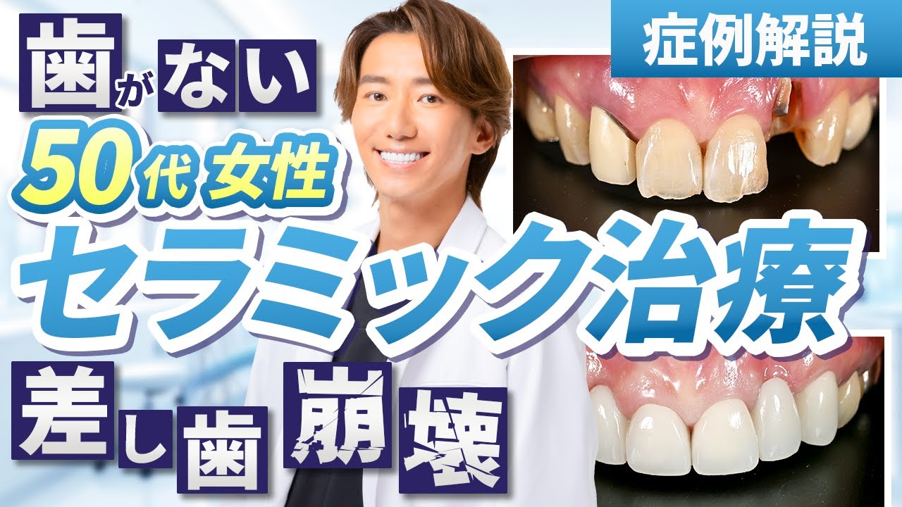 差し歯崩壊して歯がない状態の50台女性をセラミック治療でお悩み解決【症例解説】