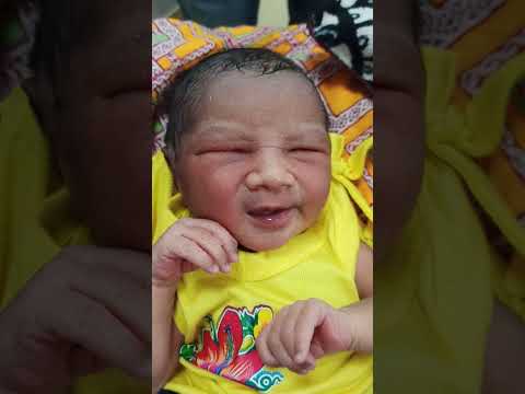 # newborn#sncu#miliaria crystallina #pediatric dermatology#dermatology