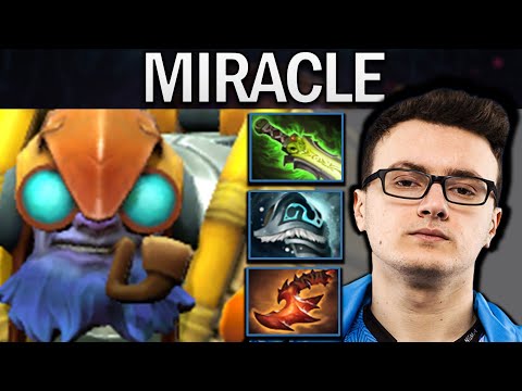 Tinker Dota 2 Gameplay Miracle with 29 Kills - Shivas