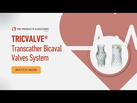 Revolutionizing Tricuspid Regurgitation Treatment: The TricValve® Solution