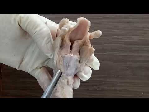 ANATOMY OF LARYNX - BY DR MITESH DAVE