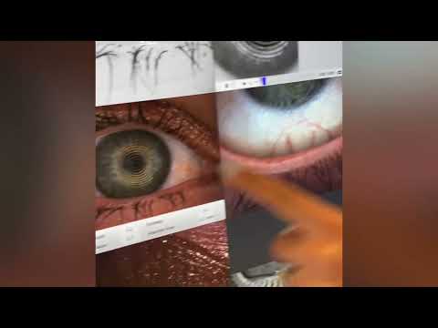 What to Expect During a Dry Eye Consultation (Video Demonstration by Dr Claudia Younany)