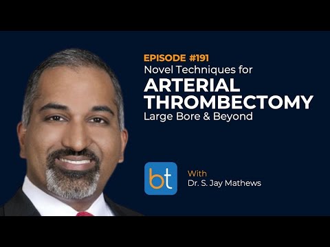 Novel Techniques for Arterial Thrombectomy: Large Bore & Beyond w/ Dr. S. Jay Mathews | Ep. 191