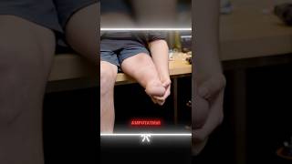 MIT Engineer BUILT His Own Leg