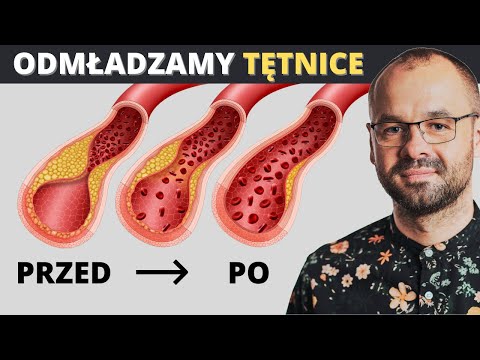 Odmładzamy i oczyszczamy tętnice. Wystarczą 3 składniki + część praktyczna.
