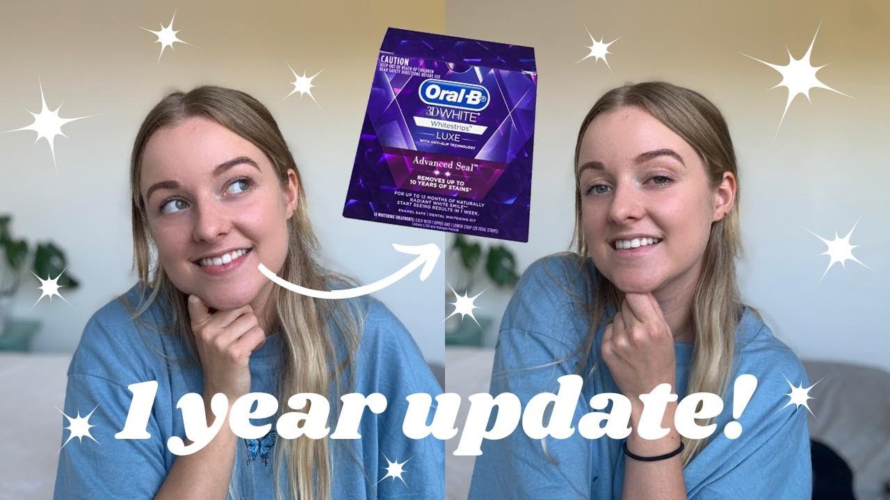 Oral B 3d Whitestrips | 1 Year update & enamel contouring!