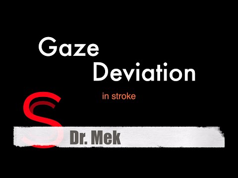 Strike Stroke with Dr. Mekdes: Gaze Deviation in Stroke (E14).