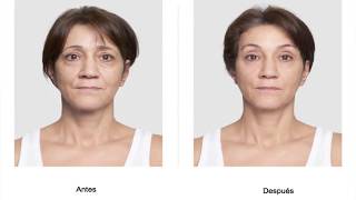 Hilos Tensores Málaga