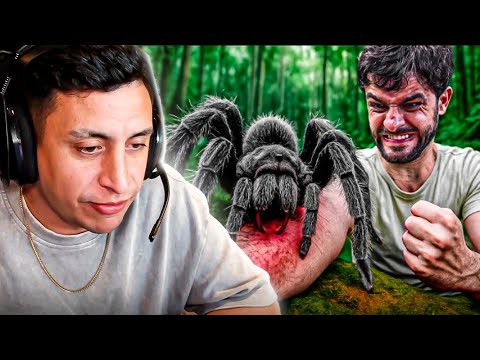 😱LO PICÓ UNA ARAÑA GOLIAT